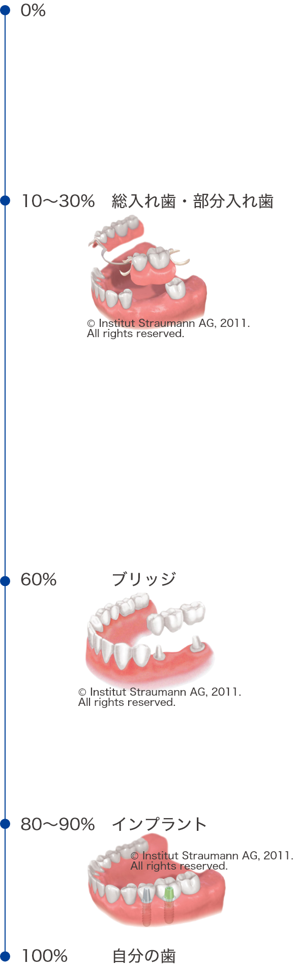 自分の歯：100％、インプラント：80～90％、ブリッジ：60％、総入れ歯・部分入れ歯：10～30％